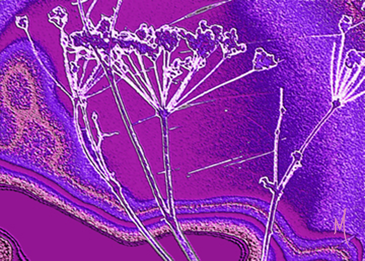 purple1